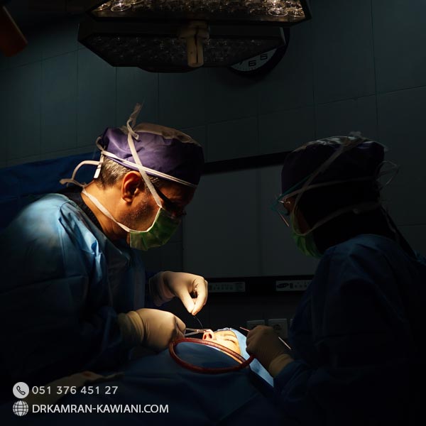 عمل بینی در مشهد - دکتر جراحی بینی مشهد در اتاق عمل