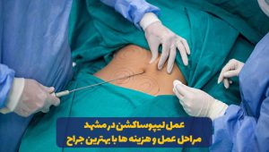 لیپوساکشن در مشهد با بهترین جراح لیپوساکشن مشهد