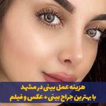هزینه و قیمت عمل بینی در مشهد با بهترین جراح بینی