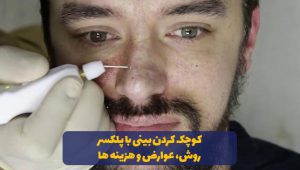 پلکسر بینی در مشهد - عوارض و هزینه ها